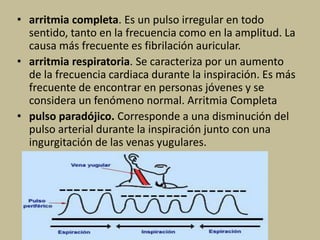 • arritmia completa. Es un pulso irregular en todo
sentido, tanto en la frecuencia como en la amplitud. La
causa más frecuente es fibrilación auricular.
• arritmia respiratoria. Se caracteriza por un aumento
de la frecuencia cardiaca durante la inspiración. Es más
frecuente de encontrar en personas jóvenes y se
considera un fenómeno normal. Arritmia Completa
• pulso paradójico. Corresponde a una disminución del
pulso arterial durante la inspiración junto con una
ingurgitación de las venas yugulares.
 