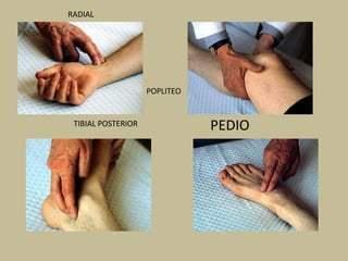 RADIAL
POPLITEO
PEDIOTIBIAL POSTERIOR
 