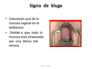 Signo de kluge
• Coloración azul de la
mucosa vaginal en el
embarazo.
• Debido a que toda la
mucosa esta atravesada
por una densa red
venosa
IRMA ILLESCAS
 