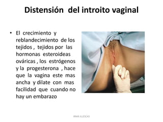 Distensión del introito vaginal
• El crecimiento y
reblandecimiento de los
tejidos , tejidos por las
hormonas esteroideas
ováricas , los estrógenos
y la progesterona , hace
que la vagina este mas
ancha y dilate con mas
facilidad que cuando no
hay un embarazo
IRMA ILLESCAS
 