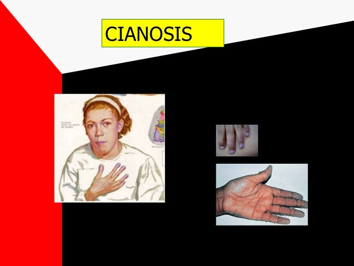 Signos Y Sintomas Cardiovasculares Signos Y Sintomas Cardiovasculares