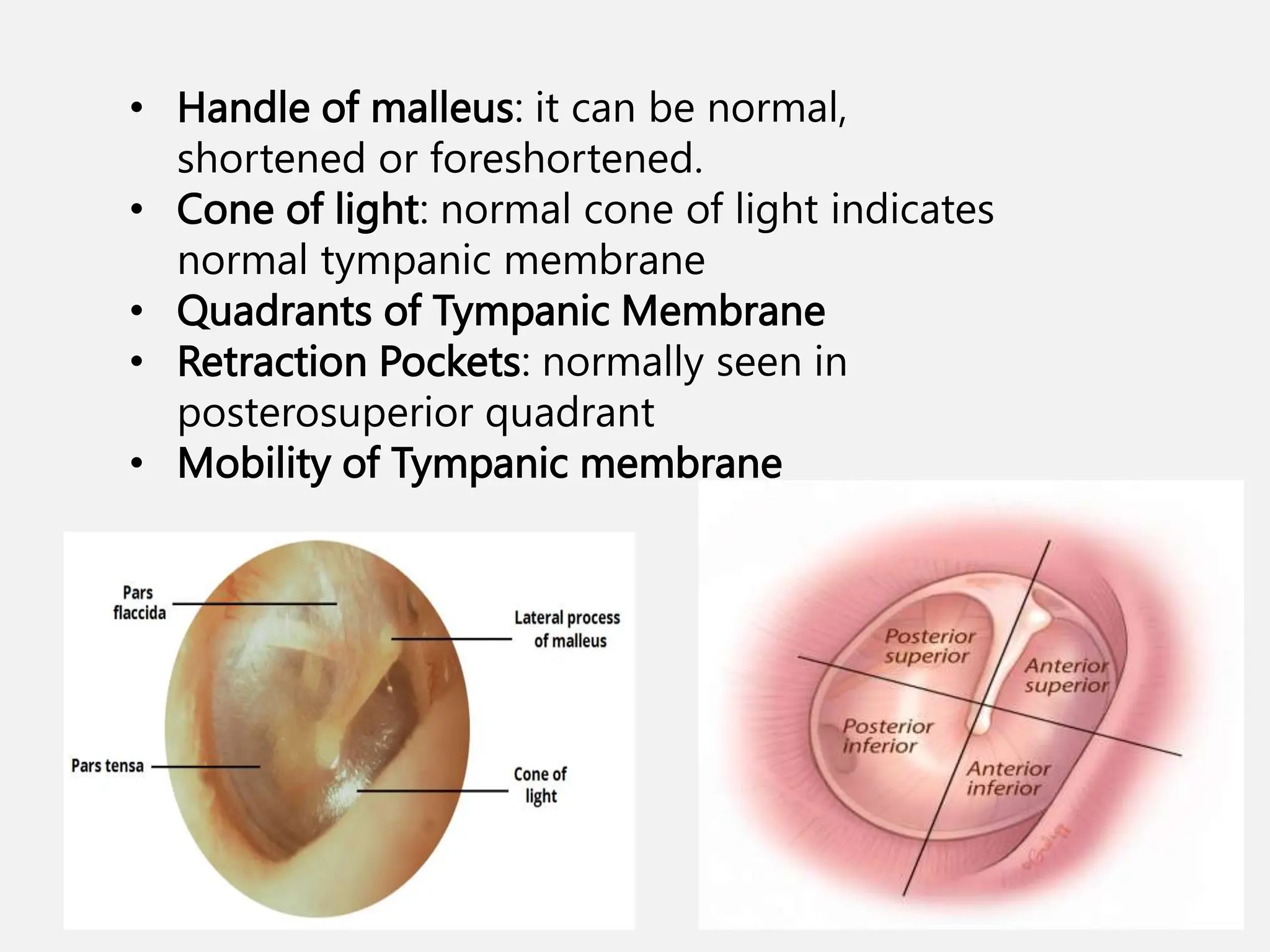 Retracted Signs and Examination of Chronic Suppurative Otitis Media | PPTX