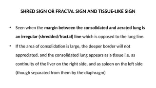 Signs and lines in usg thorax.pptx radiolgy | PPTX