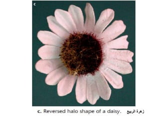 زهرة الربيع 
