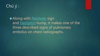 Hampton Sign Signs in chest xray | PPTX
