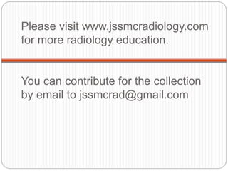 Please visit www.jssmcradiology.com
for more radiology education.
You can contribute for the collection
by email to jssmcrad@gmail.com
 