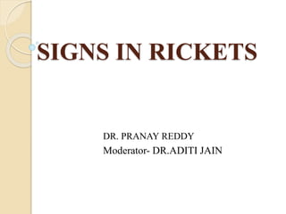 SIGNS IN RICKETS
DR. PRANAY REDDY
Moderator- DR.ADITI JAIN
 