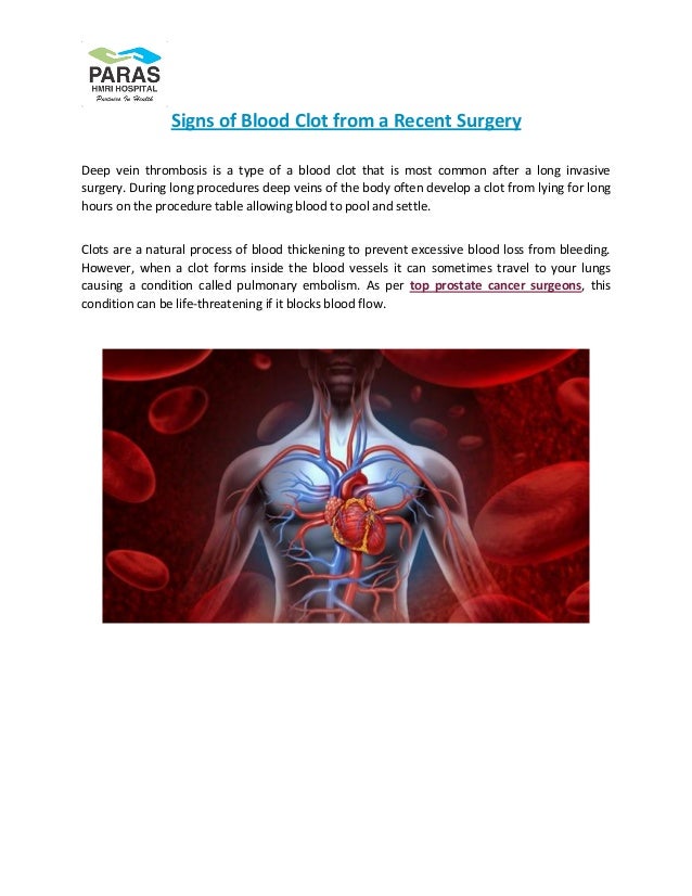 Signs of blood clot from a recent surgery pdf paras hospitals darbhan…