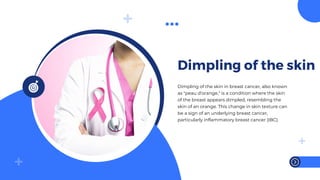 Signs of breast cancer by dr seema singh | PPTX