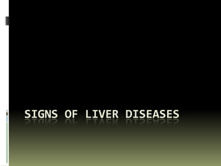 Signs of Liver Diseases 