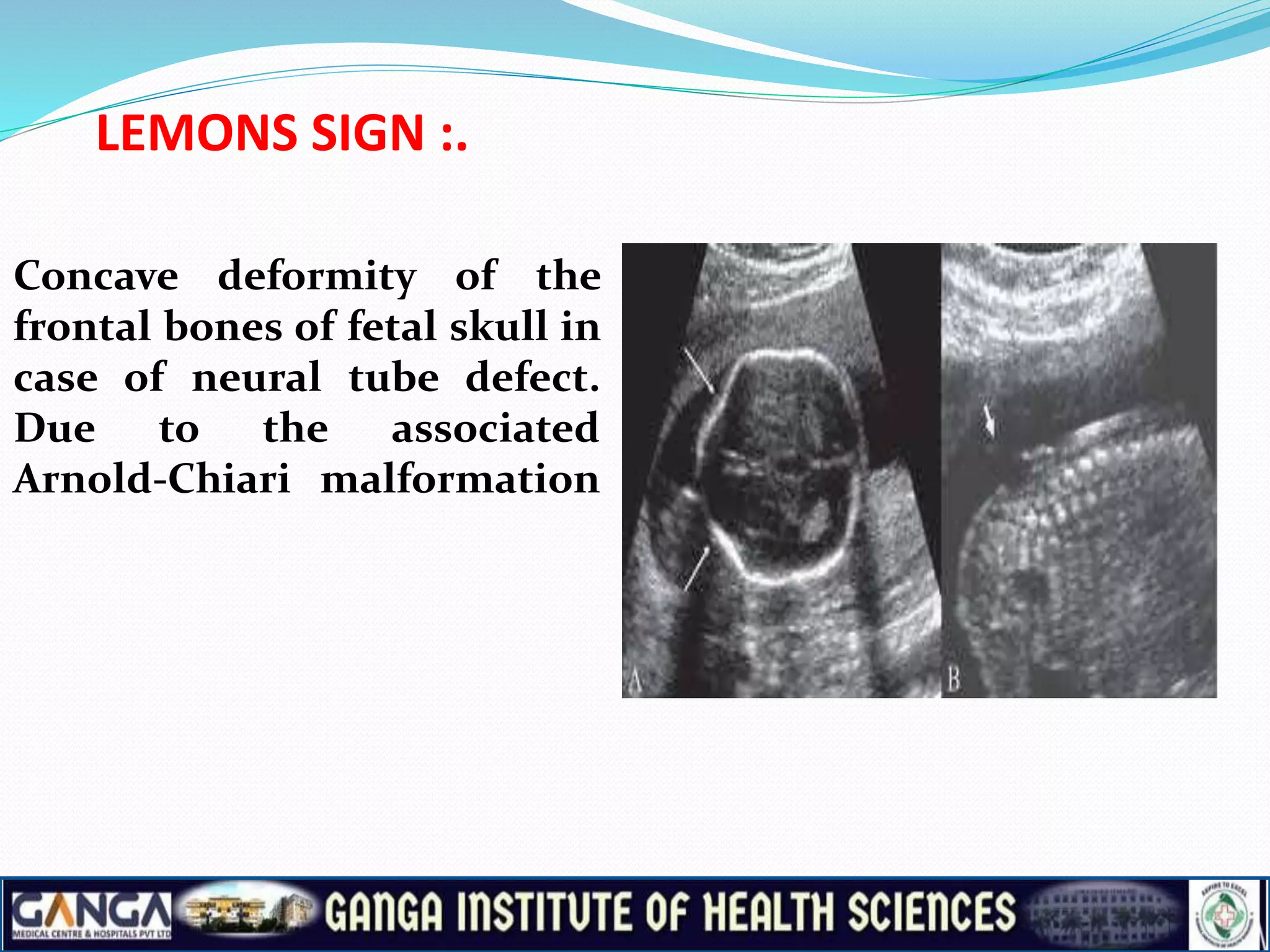 Signs of obstetrics.pptx