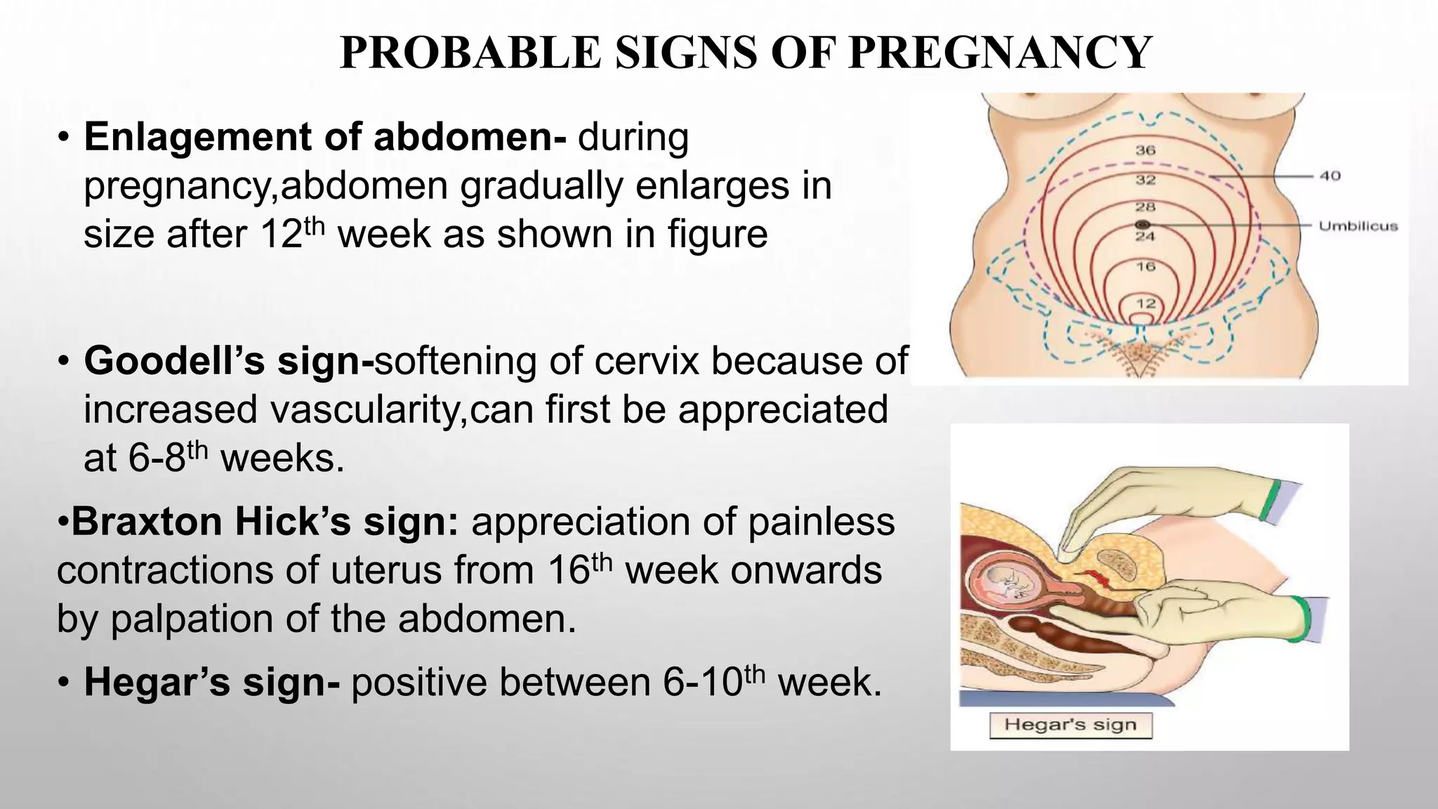 Sign Pregency Signs of pregnancy | PPTX