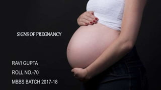 SIGNS OF PREGNANCY
RAVI GUPTA
ROLL NO.-70
MBBS BATCH 2017-18
 