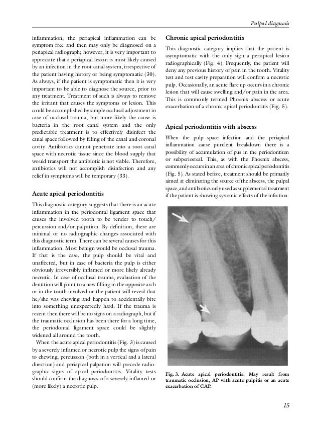 Pulpal Diagnosis