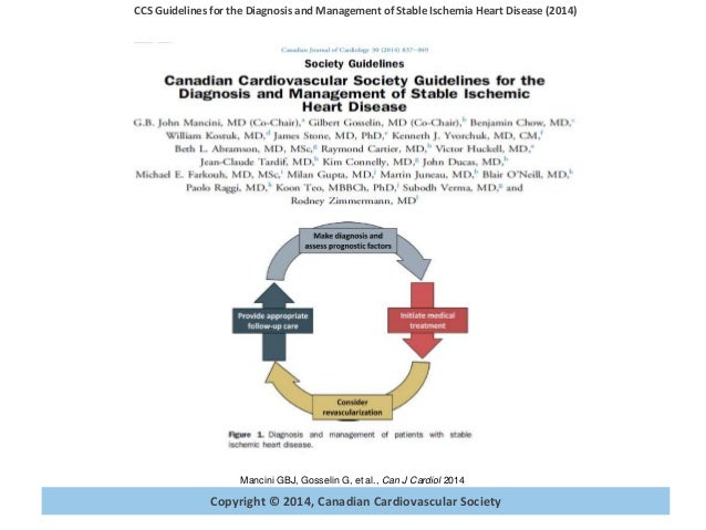 Stable Ischemic Heart Disease Guideline