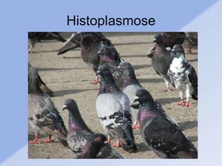 Histoplasmose
 