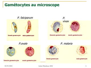 Gamétocytes au microscope


             P. falciparum                             P.
                                                       vivax




              P.ovale                                 P. malaria




04/05/2004                   Atelier Paludisme 2004                6
 