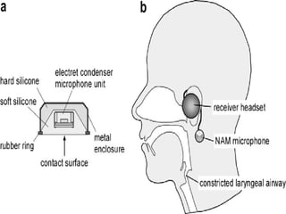 Working of Electromyography
 