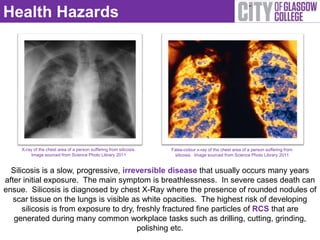 Health Hazards




     X-ray of the chest area of a person suffering from silicosis.   False-colour x-ray of the chest area of a person suffering from
          Image sourced from Science Photo Library 2011               silicosis. Image sourced from Science Photo Library 2011


  Silicosis is a slow, progressive, irreversible disease that usually occurs many years
after initial exposure. The main symptom is breathlessness. In severe cases death can
ensue. Silicosis is diagnosed by chest X-Ray where the presence of rounded nodules of
   scar tissue on the lungs is visible as white opacities. The highest risk of developing
      silicosis is from exposure to dry, freshly fractured fine particles of RCS that are
   generated during many common workplace tasks such as drilling, cutting, grinding,
                                         polishing etc.
 
