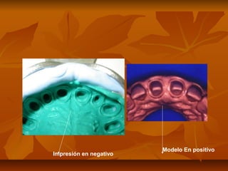 Modelo En positivo
Impresión en negativo
 