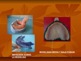 MODELINAS MEDIA Y BAJA FUSION
IMPRESIÓN SOBRE
LA MODELINA
 