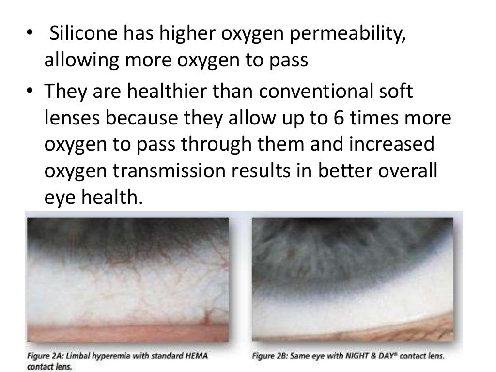 Silicone Hydrogel contact lens