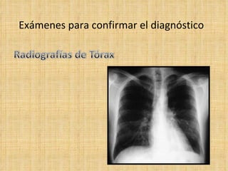 Exámenes para confirmar el diagnóstico