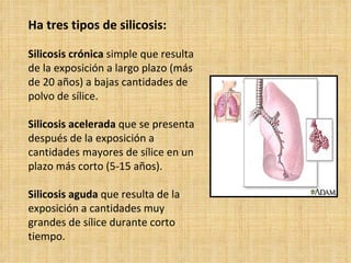 Ha tres tipos de silicosis: Silicosis crónica simple que resulta de la exposición a largo plazo (más de 20 años) a bajas cantidades de polvo de sílice. Silicosis acelerada que se presenta después de la exposición a cantidades mayores de sílice en un plazo más corto (5-15 años). Silicosis aguda que resulta de la exposición a cantidades muy grandes de sílice durante corto tiempo.