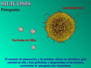 SILICOSIS   Patogenia: El aumento de plasmocitos y de proteínas séricas en silicóticos, gran cantidad de alfa y beta globu...