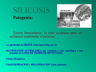 SILICOSIS  Patogenia: <ul><li>Teoría Inmunitaria: la mas aceptada pero no esclarece totalmente el proceso: </li></ul><ul><...