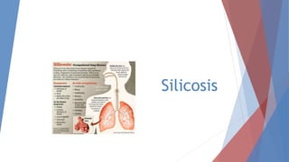 Silicosis 
 