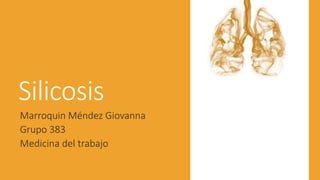 Silicosis
Marroquin Méndez Giovanna
Grupo 383
Medicina del trabajo
 