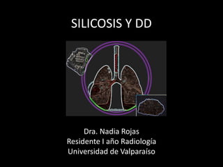 SILICOSIS Y DD
Dra. Nadia Rojas
Residente I año Radiología
Universidad de Valparaíso
 