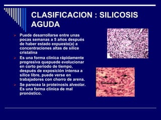 CLASIFICACION : SILICOSIS
AGUDA
 Puede desarrollarse entre unas
pocas semanas a 5 años después
de haber estado expuesto(a) a
concentraciones altas de sílice
cristalina
 Es una forma clínica rápidamente
progresiva quepuede evolucionar
en corto período de tiempo,
después de exposición intensa a
sílice libre, puede verse en
trabajadores con chorro de arena.
 Se parecea la proteinosis alveolar.
Es una forma clínica de mal
pronóstico.
 