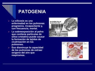 PATOGENIA
 La silicosis es una
enfermedad en los pulmones
progresiva, incapacitante y,
con frecuencia, mortal.
 La sobreexposición al polvo
que contiene partículas de
sílice cristalina puede causar
la formación de tejidos de
cicatrización en los
pulmones.
 Eso disminuye la capacidad
de los pulmones de extraer
oxígeno del aire que
respiramos.
 
