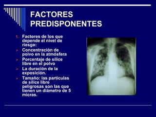 FACTORES
PREDISPONENTES
1. Factores de los que
depende el nivel de
riesgo:
 Concentración de
polvo en la atmósfera
 Porc...