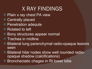 X RAY FINDINGS Plain x ray chest PA view Centrally placed Penetration adequte Rotated to left Bony structures appear normal Trachea in midline Bilateral lung parenchymal radio-opaque lesions seen Bilateral hilar nodes show well rounded radio-opaque shadow.(calcifications) Bronchectatic chages in Rt lower lobe  
