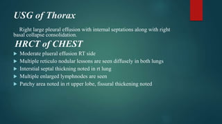USG of Thorax
Right large pleural effusion with internal septations along with right
basal collapse consolidation.
HRCT of CHEST
 Moderate plueral effusion RT side
 Multiple reticulo nodular lessons are seen diffusely in both lungs
 Interstial septal thickning noted in rt lung
 Multiple enlarged lymphnodes are seen
 Patchy area noted in rt upper lobe, fissural thickening noted
 