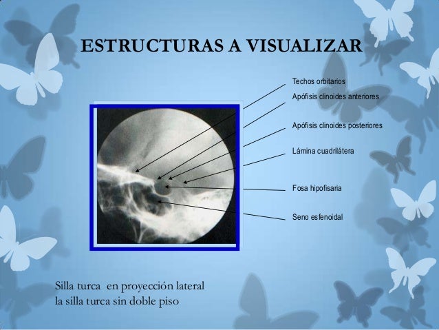 silla turca silla turca silla turca silla turca