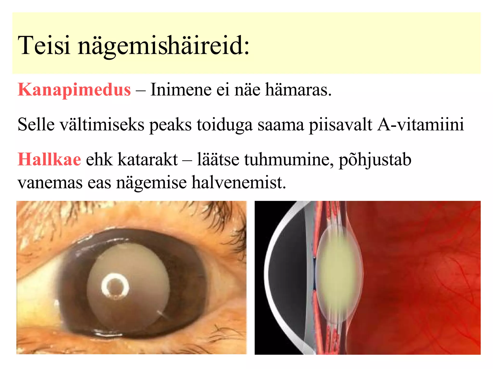 Teisi nägemishäireid:   Kanapimedus  – Inimene ei näe hämaras. Selle vältimiseks peaks toiduga saama piisavalt A-vitamiini Hallkae  ehk katarakt – läätse tuhmumine, põhjustab vanemas eas nägemise halvenemist.   