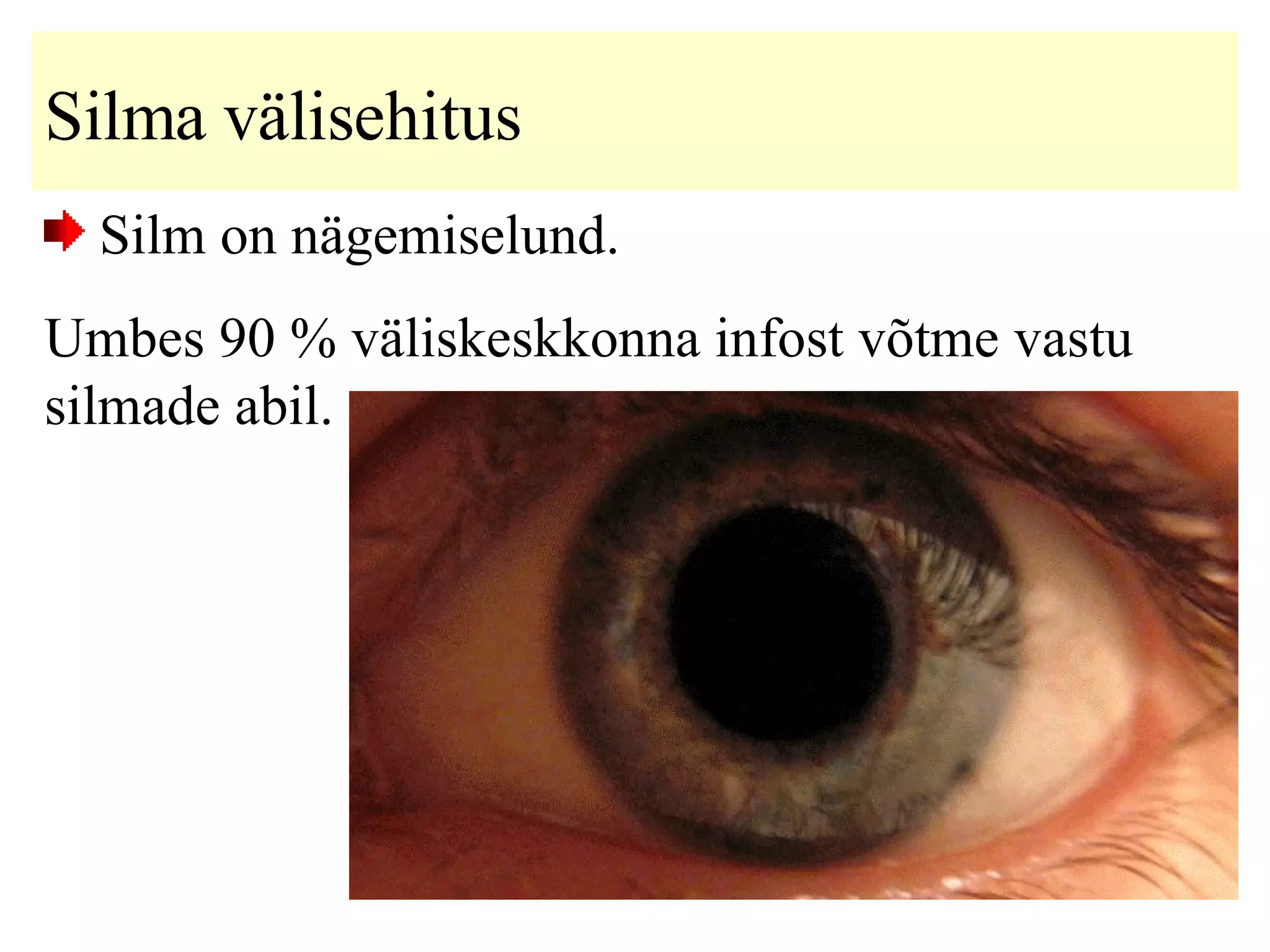 Silma välisehitus Silm on nägemiselund. Umbes 90 % väliskeskkonna infost võtme vastu silmade abil. 