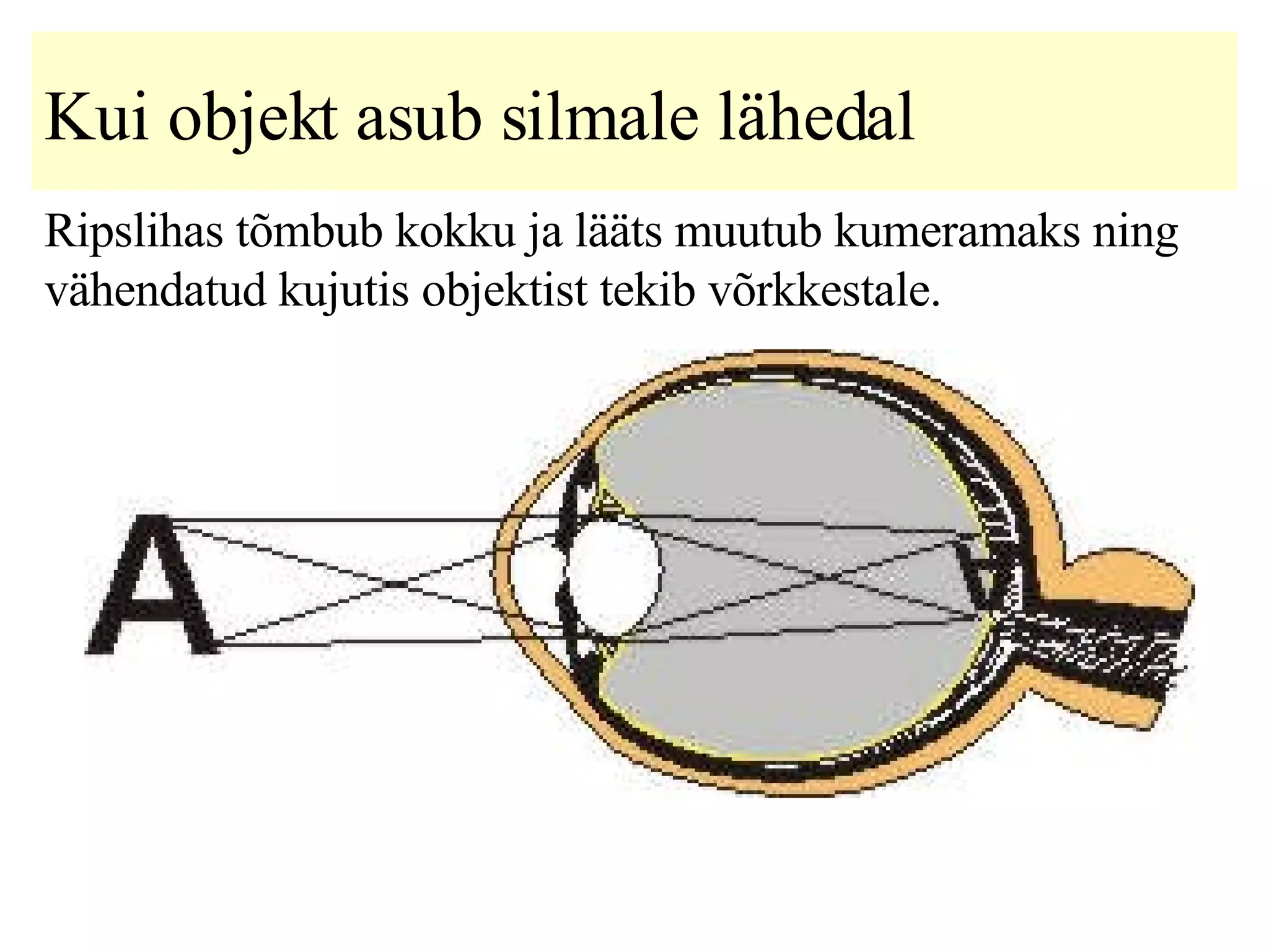 Kui objekt asub silmale lähedal   R ipslihas tõmbub kokku ja lääts muutub kumeramaks ning vähendatud kujutis objektist tekib võrkkestale .   