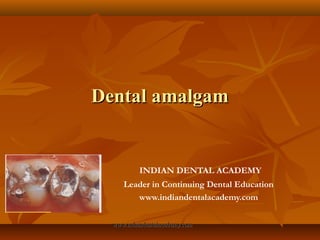 Dental amalgam


           INDIAN DENTAL ACADEMY
     Leader in Continuing Dental Education
        www.indiandentalacademy.com

  www.indiandentalacademy.com
 