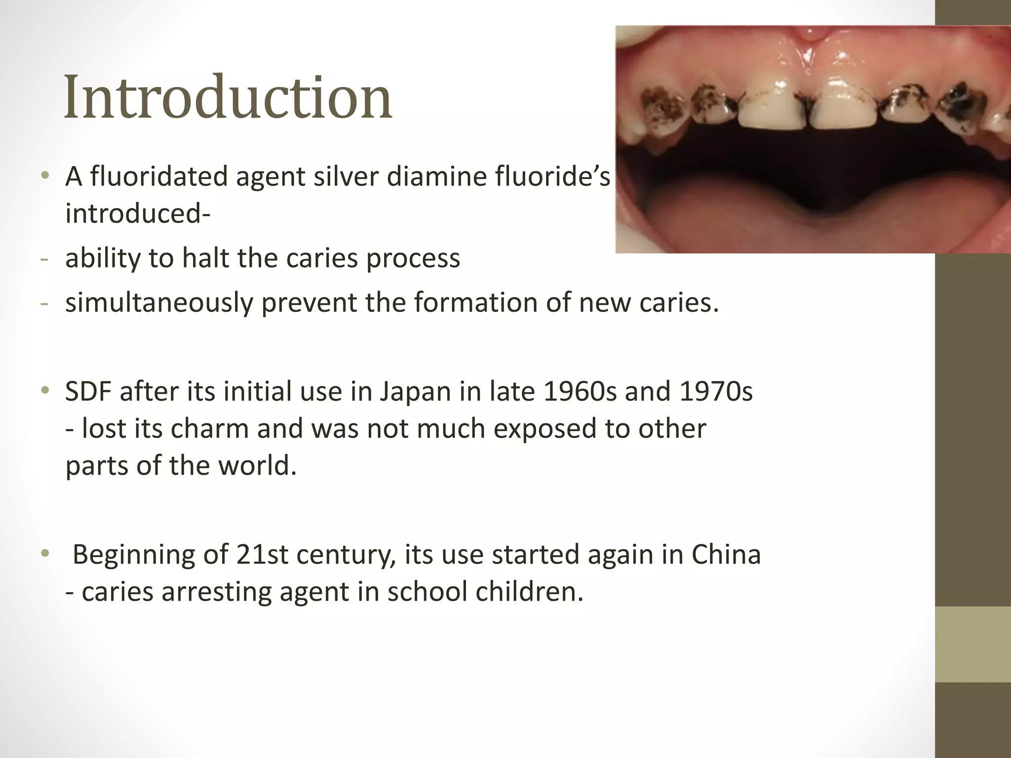 Silver diamine fluoride | PPTX