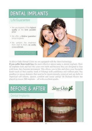 6
At Silver Oaks Dental Clinic we are equipped with the latest technology.
If you suffer from tooth loss the most effective option today is dental implants. Den-
tal implants look and feel like your own teeth and because they are designed to fuse
with bone, they become permanent. This allows you to bite and chew your favourite
foods (such as that yummy steak or biltong) with confidence and without pain. Say
goodbye to messy dentures that need to be inconveniently removed and say hello to
improved self esteem, speech, comfort and easier eating! Dr Richard Huson has
placed in excess 500 implants – all with excellent results.
 