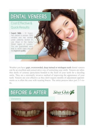 7
Weather you have gaps, overcrowded, deep stained or mishapen teeth dental veneers
can be an excellent and conservative way of correcting your smile. Veneers are ultra-
thin shells of ceramic (porcelain) bonded to the front of your teeth for a dazzling
smile. They are a minimally invasive method of improving the appearance of your
teeth. Veneers are cost effective as they don't require months of adjustment appoint-
ments as is often the case with wearing braces. The entire process takes just 2-3 vis-
its.
 