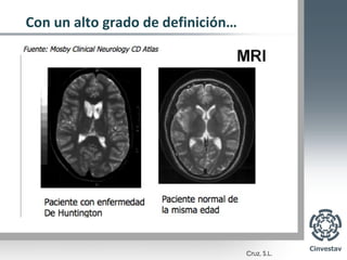 Con un alto grado de definición…
 