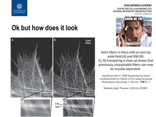 SAHLGRENSKA ACADEMY
Ok but how does it look
CENTRE FOR CELLULAR IMAGING (CCI)
NATIONAL MICROSCOPY INFRASTRUCTURE
RAFAEL CAMACHO
Actin fibers in HeLa cells as seen by
wide field (A) and SIM (B).
C), D) Comparing a close up shows that
previously unresolvable fibers can now
be visually separated.
Gustafsson M G L 2000 Surpassing the lateral
resolution limit by a factor of two using structured
illumination microscopy J. Microsc. 198 82–7
Methods Appl. Fluoresc. 6(2018), 022003.
 