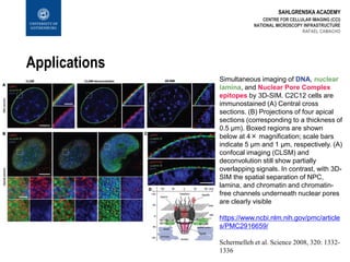 SAHLGRENSKA ACADEMY
Applications
CENTRE FOR CELLULAR IMAGING (CCI)
NATIONAL MICROSCOPY INFRASTRUCTURE
RAFAEL CAMACHO
Simultaneous imaging of DNA, nuclear
lamina, and Nuclear Pore Complex
epitopes by 3D-SIM. C2C12 cells are
immunostained (A) Central cross
sections. (B) Projections of four apical
sections (corresponding to a thickness of
0.5 µm). Boxed regions are shown
below at 4× magnification; scale bars
indicate 5 µm and 1 µm, respectively. (A)
confocal imaging (CLSM) and
deconvolution still show partially
overlapping signals. In contrast, with 3D-
SIM the spatial separation of NPC,
lamina, and chromatin and chromatin-
free channels underneath nuclear pores
are clearly visible
https://www.ncbi.nlm.nih.gov/pmc/article
s/PMC2916659/
Schermelleh et al. Science 2008, 320: 1332-
1336
 
