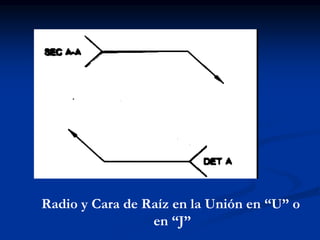 Radio y Cara de Raíz en la Unión en “U” o
en “J”
 